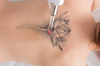 Dövme düzeltme hakkında her şey