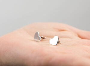 Gümüş neden sararır ve bu konuda ne yapmalı??